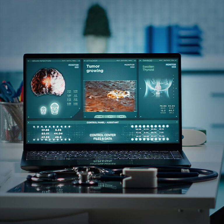 Intelligent ICSR Processing & Signal Detection